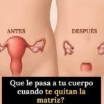 Los Efectos de la Histerectomía: Lo Que No Te Cuentan los Médicos