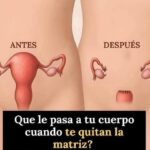Impacto de la Histerectomía en el Cuerpo Femenino: Efectos y Remedios Naturales