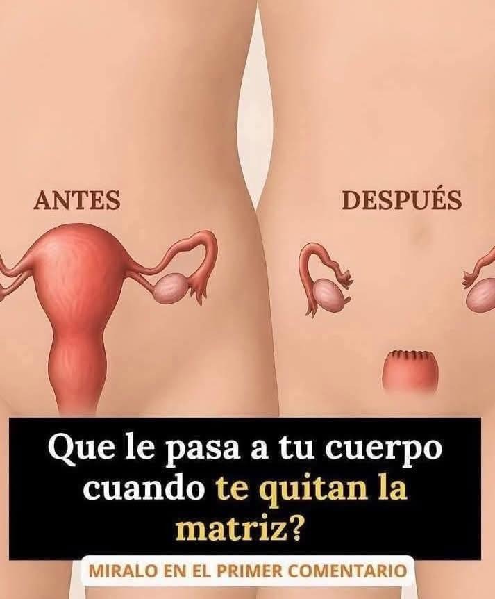 Comparación de antes y después de una histerectomía