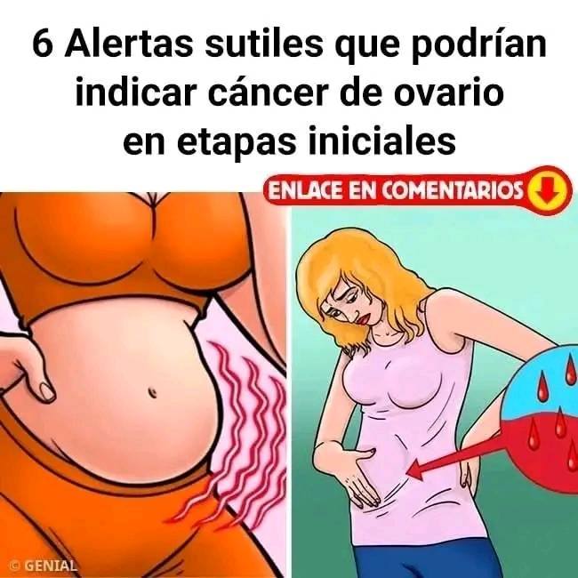 Señales tempranas del cáncer de ovario