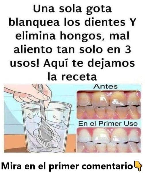 Remedio casero para blanquear dientes y eliminar hongos