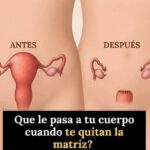 ¿Qué Sucede en tu Cuerpo Tras una Histerectomía? Cambios y Consejos