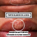Todo lo que Necesitas Saber sobre los Puntos Blancos en la Boca