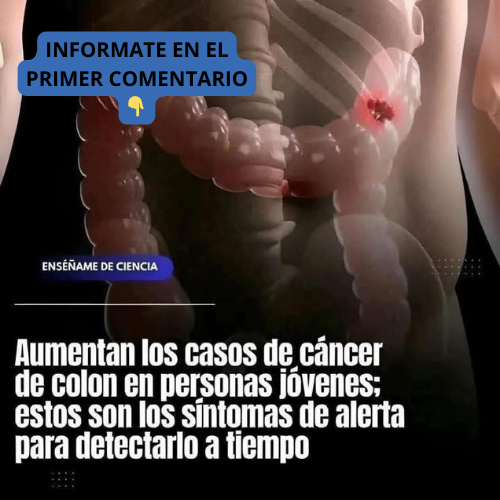 Ilustración del sistema digestivo humano enfocando el colon en riesgo de cáncer