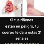 21 Signos de Alerta: Cómo Reconocer los Problemas Renales a Tiempo