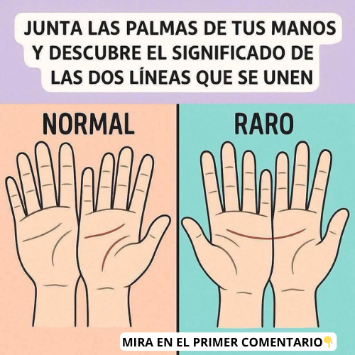 Manos con líneas de diferentes tipos