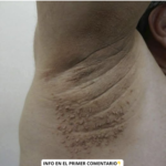 Los Primeros Síntomas de Problemas de Salud y Cómo Aliviarte con Remedios Naturales